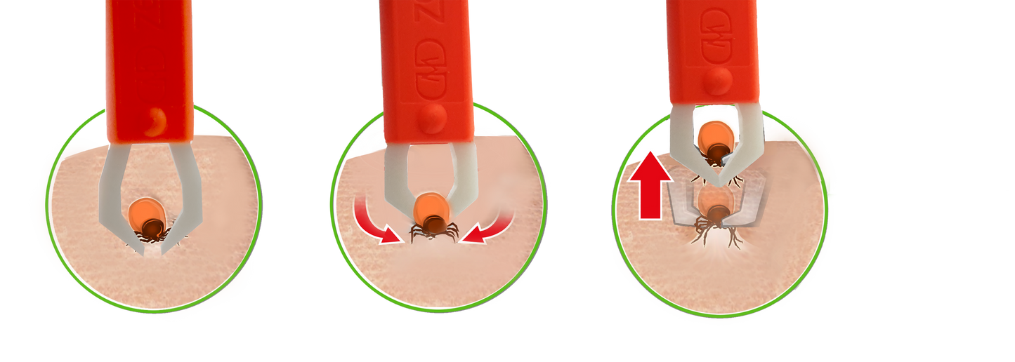 pinzas para garrapatas